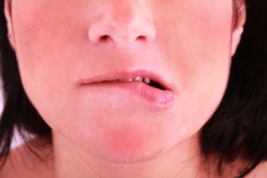 Five Chronic Skin Conditions that need Immediate Care